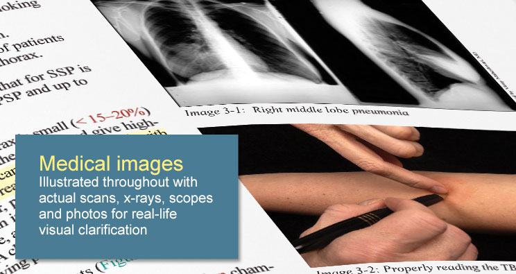 medstudy-Internal-Medicine-Core-Curriculum-اینترنال مدیسن طب داخلی 2014